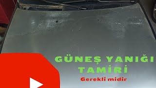 Güneş Yanığı Nasıl Düzelir Boyasız Verniksiz düzelir mi Bilmeniz Gerekenler [upl. by Iztim]