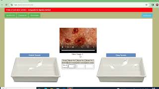 Experiment 22 Study of anti ulcer activity  using pylorus ligation method or SHAY method [upl. by Humph]