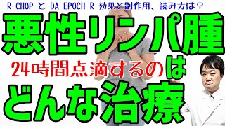 笠井アナ5日間の抗がん剤投与終了 びまん性大細胞型Ｂ細胞リンパ腫で24時間の点滴が必要な治療の名称は RCHOP及びDAEPOCHRの呼び方・読み方は [upl. by Eenobe]