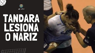 Tandara sofre uma lesão no nariz  Superliga Feminina 20192020 [upl. by Bremer]