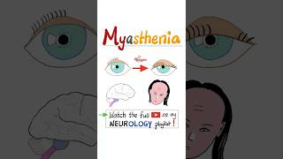 Myasthenia Gravis MG  Muscle Weakness Fatigue…science anatomy pathology health nurse mbbs [upl. by Glaudia]