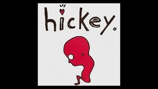 HICKEY  Hickey FULL ALBUM [upl. by Giselbert]