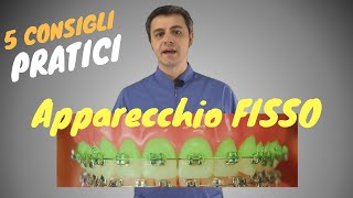 5 consigli pratici per sopravvivere con lapparecchio fisso [upl. by Kitrak]