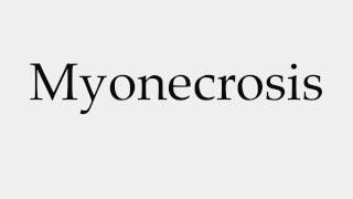 How to Pronounce Myonecrosis [upl. by Georgy]