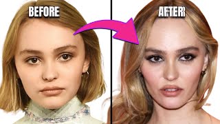 Has Plastic Surgery Prematurely Aged Lily Rose Depp [upl. by Enatan88]