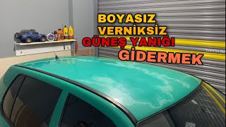 BOYASIZ  VERNİKSİZ  GÜNEŞ YANIKLARINI GİDERMEK  DETAYLI [upl. by Amalberga]