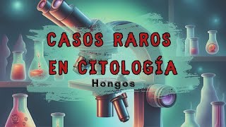 Casos raros en citología Cokeromyces recurvatus [upl. by Anauqat308]