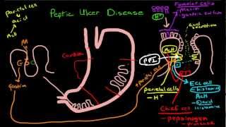 Peptic Ulcer Disease Pathophysiology [upl. by Ahsaret]