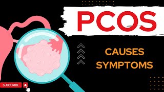 PolyCystic Ovary Syndrome PCOS  What if you have PCOS  PCOS early signs [upl. by Zared]