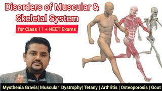 Disorders of Muscular and Skeletal System  Class 11 NCERT NEET Exams  Pashupati Sir [upl. by Barbey]