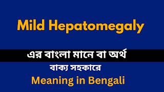 Mild Hepatomegaly Meaning in Bengali Mild Hepatomegaly শব্দের বাংলা ভাষায় অর্থ অথবা মানে কি [upl. by Phip367]