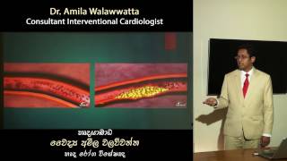 VIDEO 2  STABLE ANGINA  ස්ථාවර හෘදයාබාධ  Dr Amila Walawwatta [upl. by Jennie]