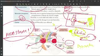 42 Aphasia amp Dysarthria [upl. by Curry]