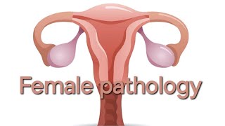 Female pathology 5th lecture [upl. by Shawn]