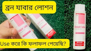 Clindacin Lotion  মুখের ব্রন ও চোখের নিচের কালো দাগ দূর করার লোশন  Incepta Pharmaceuticals Ltd [upl. by Penoyer]