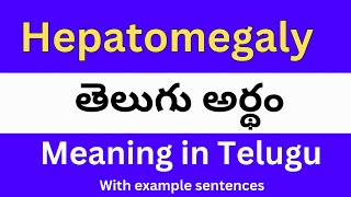 Hepatomegaly meaning in telugu with examples  Hepatomegaly తెలుగు లో అర్థం Meaning in Telugu [upl. by Enyala]