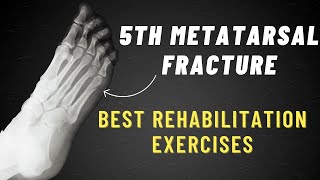 5th Metatarsal Fracture Exercises  6 Week Program [upl. by Aical]