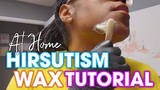 HOW TO WAX AT HOME  CHIN WAX EDITION  HIRSUTISM  PCOS [upl. by Eixam30]