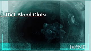 The Basics DVT Blood Clots  WebMD [upl. by Hansiain]