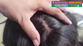 hair wig service islamabad rawalpindi pakistan 03007431947 gujranwalahairclub Arshadhairclub hair [upl. by Paske]