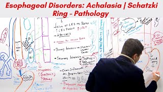 Esophageal Disorders Achalasia  Schatzki Ring  Pathology  GI  Subash Acharya [upl. by Moskow]