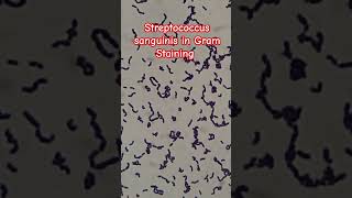 Identifying GramPositive Bacteria Streptococcus sanguinis in Chains [upl. by Drud]