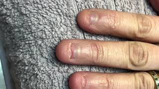 Short bitten nails how to apply acrylic [upl. by Ettelloc]