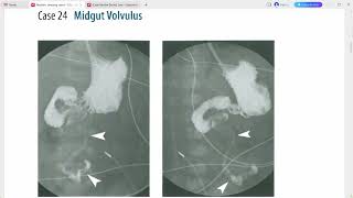 RADIOLOGY EXAM CASES [upl. by Nwaf]