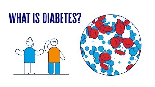 What Is Diabetes  2 Minute Guide  Diabetes UK [upl. by Ahsinad378]