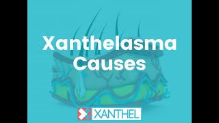 XANTHELASMA CAUSES What are the cause of Xanthelasma and Xanthomas  Brought To You By XANTHEL ® [upl. by Smailliw817]