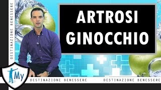 Artrosi del ginocchio [upl. by Eachelle]