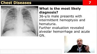 Chest Quick note internalmedicine cme usmle محاضراتباطنة ecg clinical medicine [upl. by Filmore]