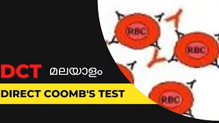 DCTDirect Coombs test മലയാളം [upl. by Hervey]