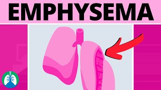 Emphysema Medical Definition  Quick Explainer Video [upl. by Enelloc]