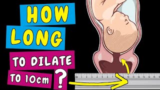 When will my Dilation start and how long will it take to dilate to 10cm [upl. by Bow472]