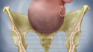 Fetal Descent Birth Station Progress Dilation Effacement Labor Contractions [upl. by Ylro]