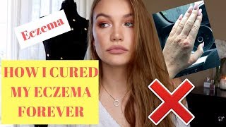 HOW I CURED MY ECZEMA FOREVER [upl. by Ayekehs]