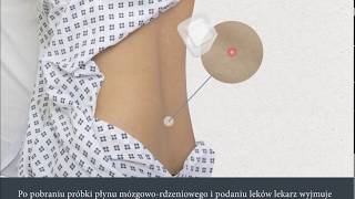 Lumbar Puncture Polish  Nakłucie lędźwiowe [upl. by Ntsuj]