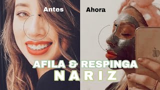 Afina y respinga tu nariz sin cirugía  Anderlyn Prado [upl. by Namlak331]