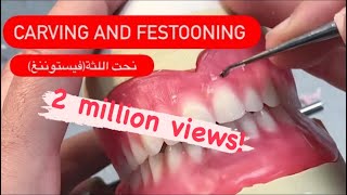 Wax up carving and festooning waxbae dentures [upl. by Lleval]