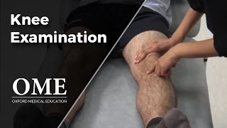 Knee Examination  Orthopaedics [upl. by Mandal]