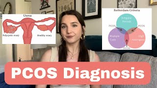 I was diagnosed with PCOS Where do I go from here [upl. by Durman]