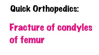 QUICK ORTHOPEDICS Fracture of condyles of Femur [upl. by Atihcnoc962]