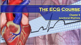 The ECG Course  Junctional Rhythms [upl. by Annahsohs172]