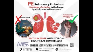 Pulmonary Embolism Traditional Surgery VS MISS [upl. by Vharat231]