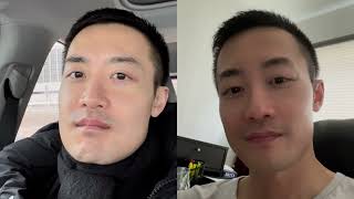 UNDERBITE JAW SURGERY VLOG 40  PostOp Sleeping Questions Answered  Sleep Elevated How [upl. by Arihsay]