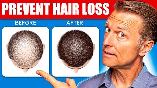 12 Proven Remedies to Prevent Hair Loss and Regrowth Regrow hair [upl. by Kcir]