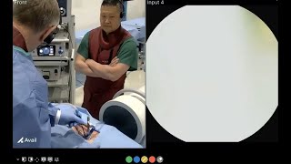 TELIGENTM System VueLIFTTM Procedure with Dr Michael Wang and Dr Richard Fessler [upl. by Aihsemaj]