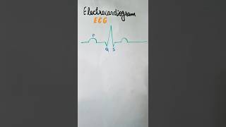 Electrocardiogram ECG shortvideo shorts viralshort youtubeshorts ecg [upl. by Harolda]