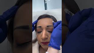 Come get botox with me shorts botox botoxtreatment filler injection antiaging [upl. by Nnayd]